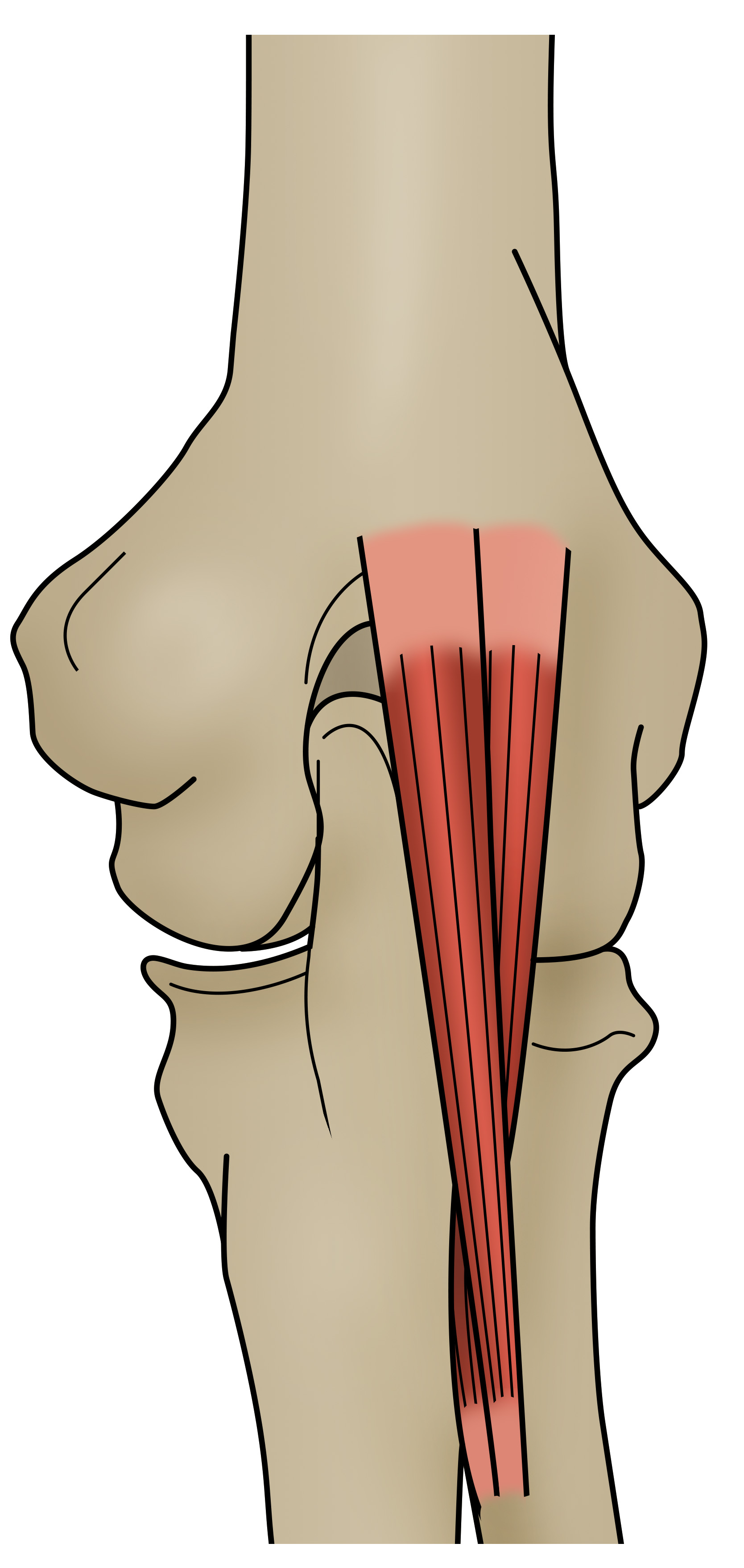 Sports Injury Bulletin - Diagnose & Treat - Masterclass: Distal bicep ...