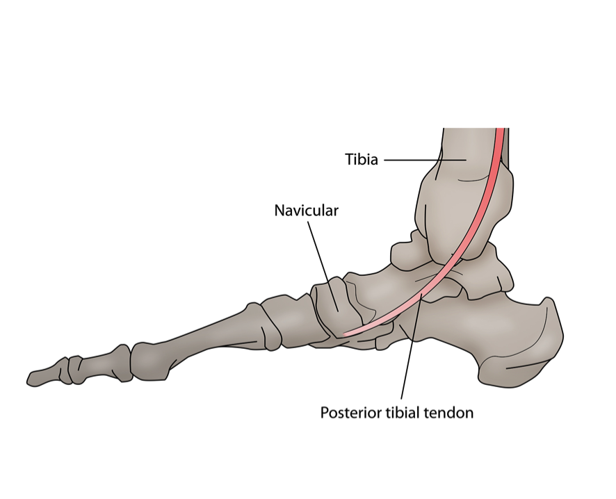 Sports Injury Bulletin - Anatomy - Tibialis posterior tendon: a key ...