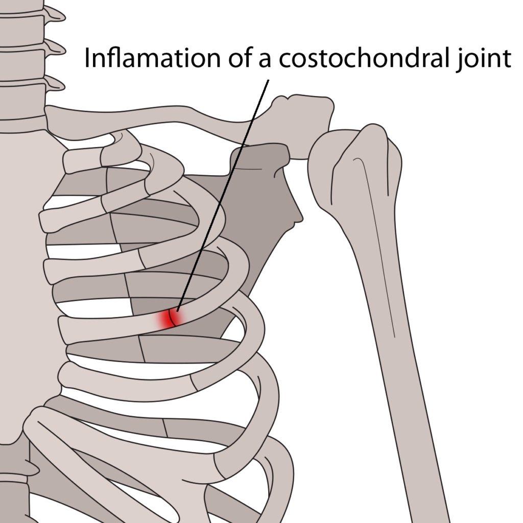 Sports Performance Bulletin Injuries & health Rib injuries in