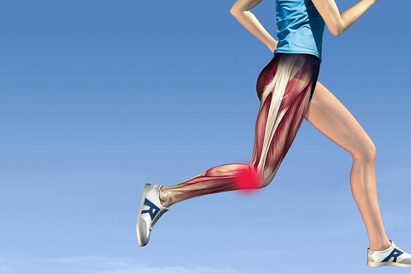 Lateral knee injury: don’t get sidelined by iliotibial band syndrome