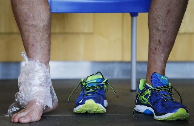 Uncommon injuries: the deltoid ligament
