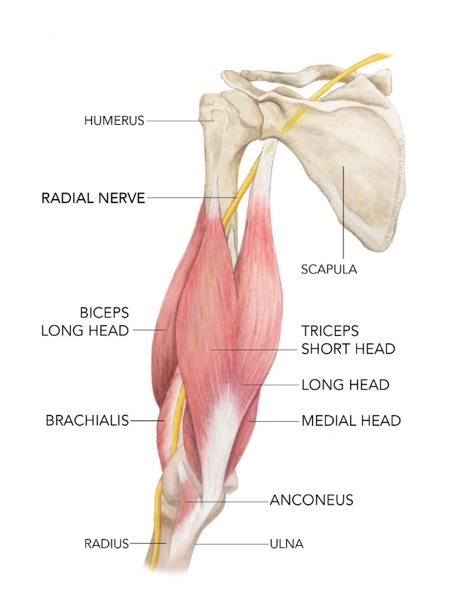 triceps strain